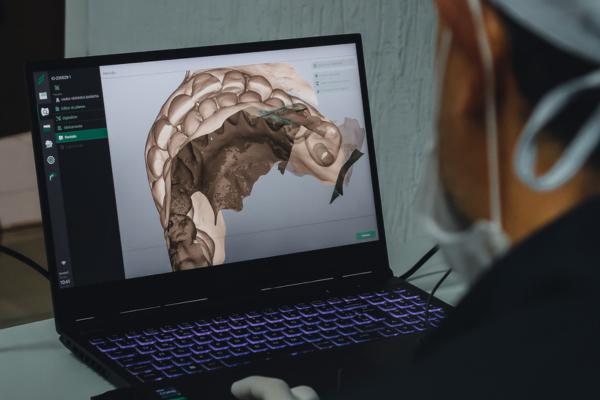 Imagem do curso: Especialização Dupla Formação em Implantodontia e Periodontia - 2ª turma